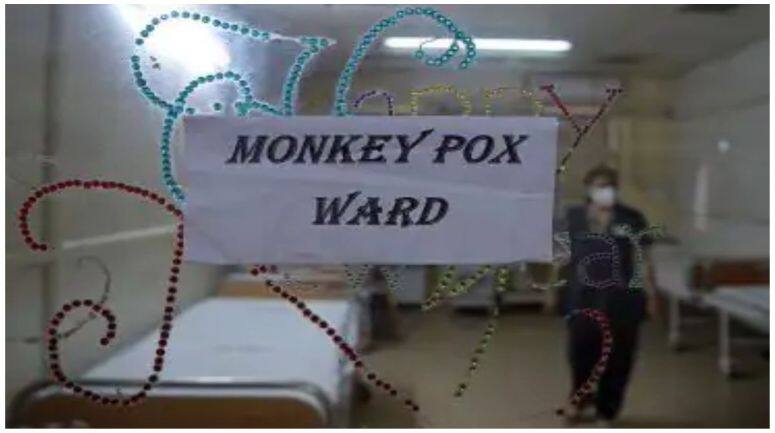 Monkeypox Alert: Virus Confirmed in Patient at Delhi's LNJP Hospital