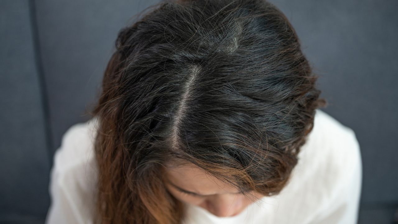 Hair Breakage vs. Thinning: Discover Effective Solutions!